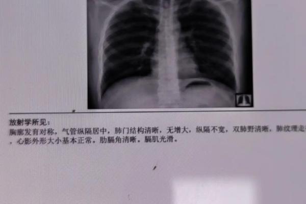 恒瑞医药dr是什么意思